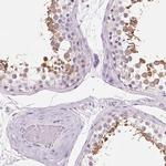 ROPN1L Antibody in Immunohistochemistry (IHC)