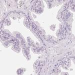 ROPN1L Antibody in Immunohistochemistry (IHC)