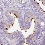 ROPN1L Antibody in Immunohistochemistry (IHC)