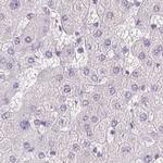 ROPN1L Antibody in Immunohistochemistry (IHC)