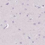 ROPN1L Antibody in Immunohistochemistry (IHC)