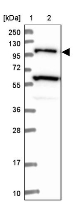 USP6NL Antibody in Western Blot (WB)