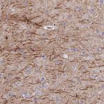 C10orf4 Polyclonal Antibody