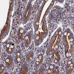 PRRC1 Antibody in Immunohistochemistry (Paraffin) (IHC (P))
