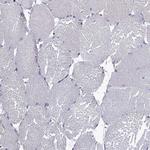 PRRC1 Antibody in Immunohistochemistry (Paraffin) (IHC (P))