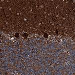 RNF90 Antibody in Immunohistochemistry (Paraffin) (IHC (P))