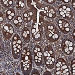 RNF90 Antibody in Immunohistochemistry (Paraffin) (IHC (P))