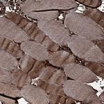 RNF90 Antibody in Immunohistochemistry (Paraffin) (IHC (P))