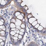 ACY3 Antibody in Immunohistochemistry (IHC)