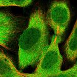 RNH1 Polyclonal Antibody