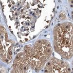 RNH1 Antibody in Immunohistochemistry (IHC)