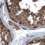 RNH1 Antibody in Immunohistochemistry (IHC)