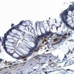 RNH1 Antibody in Immunohistochemistry (IHC)