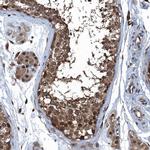 RNH1 Antibody in Immunohistochemistry (IHC)