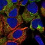 UNC45A Polyclonal Antibody