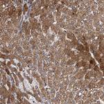 SDS Antibody in Immunohistochemistry (Paraffin) (IHC (P))
