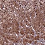 KLHL35 Polyclonal Antibody