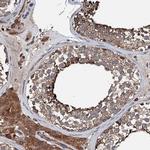 FGD4 Antibody in Immunohistochemistry (IHC)