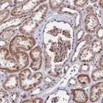 ZC3H10 Polyclonal Antibody