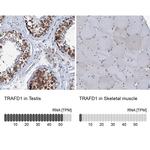 TRAFD1 Antibody in Immunohistochemistry (IHC)
