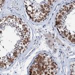 TRAFD1 Antibody in Immunohistochemistry (IHC)