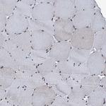 TRAFD1 Antibody in Immunohistochemistry (IHC)