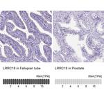 LRRC18 Antibody in Immunohistochemistry (IHC)