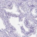 LRRC18 Antibody in Immunohistochemistry (IHC)