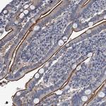 IFITM5 Polyclonal Antibody