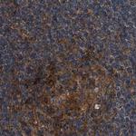 PEX5 Antibody in Immunohistochemistry (Paraffin) (IHC (P))