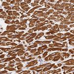 MYL2 Polyclonal Antibody