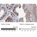 TRAFD1 Polyclonal Antibody