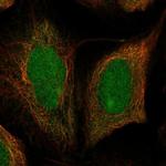 DIS3 Polyclonal Antibody