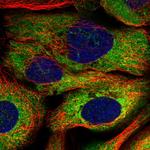 LARP4 Polyclonal Antibody