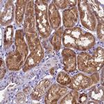 LARP4 Antibody in Immunohistochemistry (Paraffin) (IHC (P))