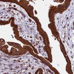LARP4 Antibody in Immunohistochemistry (Paraffin) (IHC (P))