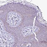 LARP4 Antibody in Immunohistochemistry (Paraffin) (IHC (P))