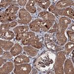 KIF18A Antibody in Immunohistochemistry (Paraffin) (IHC (P))