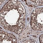 KIF18A Antibody in Immunohistochemistry (Paraffin) (IHC (P))