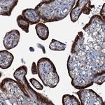 KDELC2 Antibody in Immunohistochemistry (Paraffin) (IHC (P))