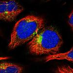 APLP2 Polyclonal Antibody