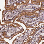 APLP2 Antibody in Immunohistochemistry (Paraffin) (IHC (P))