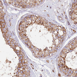 APLP2 Antibody in Immunohistochemistry (Paraffin) (IHC (P))