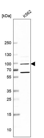 C12orf30 Antibody in Western Blot (WB)