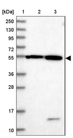 DEPDC4 Antibody in Western Blot (WB)