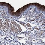DEPDC4 Antibody in Immunohistochemistry (IHC)