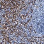 SDPR Antibody in Immunohistochemistry (IHC)