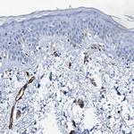 SDPR Antibody in Immunohistochemistry (IHC)