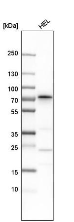 SDPR Antibody in Western Blot (WB)