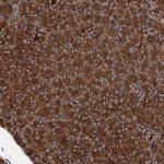 RNF214 Antibody in Immunohistochemistry (Paraffin) (IHC (P))